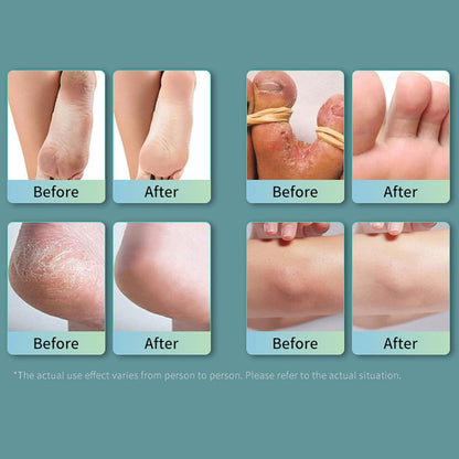 Ansiyi - Foot Bacteria Bacteriostasis Spray (Original)