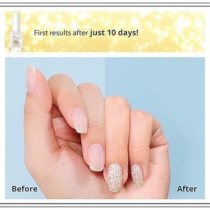 Eveline Cosmetics - 8-in-1 Nail Conditioner with Golden Particles (Original)